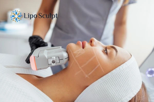 HIFU vs Botulinum Toxin: Understanding the Differences 1 HIFU vs Botox Edinburgh What is the best option for you?