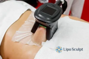 Does Fat Freezing At Home Work? 3 Fat freezing at home from Lipo Sculpt Edinburgh